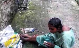 পরনে হাসপাতালের পোশাক, ক্যাথিটার রাস্তায় ঘষ্টাচ্ছে, দেখেই বোঝা যাচ্ছে মহিলা অসুস্থ, মহিলা নির্বিকার ভাবে উদ্ভ্রান্তর মতন হেঁটেই চলেছেন, কেউ ফিরেও তাকাচ্ছে না, এমনটাই মর্মান্তিক দৃশ্য দেখা গেলো সোমবার সকালে নবদ্বীপের আগমেশ্বরী পাড়ায়